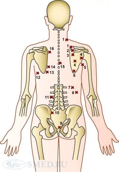 Боли в спине справа от позвоночника. Болит спина. Точки на позвоночнике. Точки возле позвоночника. Точка под левой лопаткой.