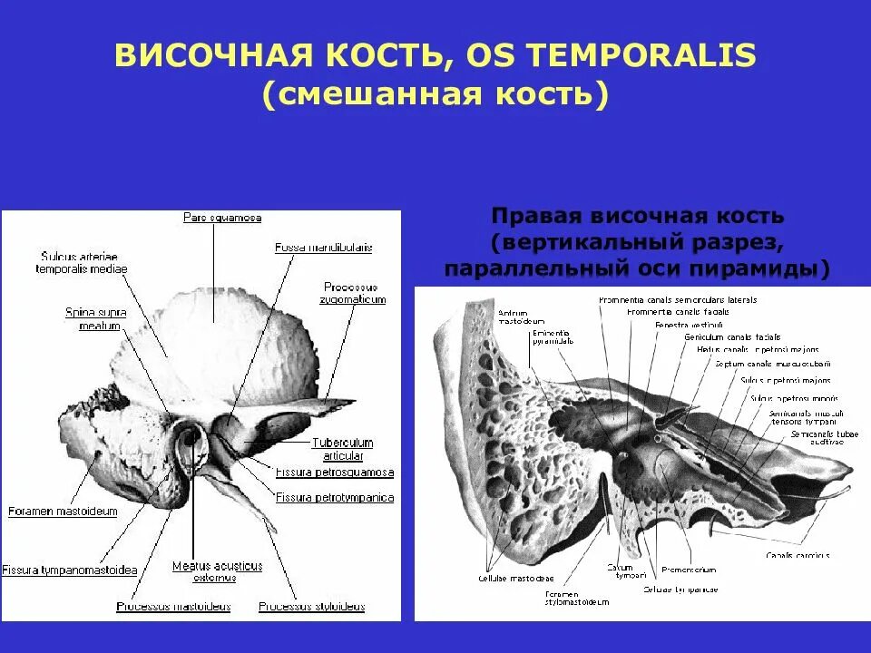 Изменения височной кости. Строение височной кости вид снизу. Анатомия височной кости вид снизу. Височная кость Синельников. Анатомия височной кости основания черепа.