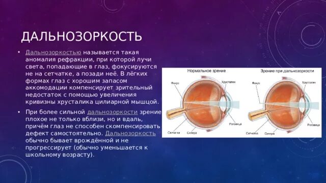 Изображение попадает если оно расположено впереди сетчатки