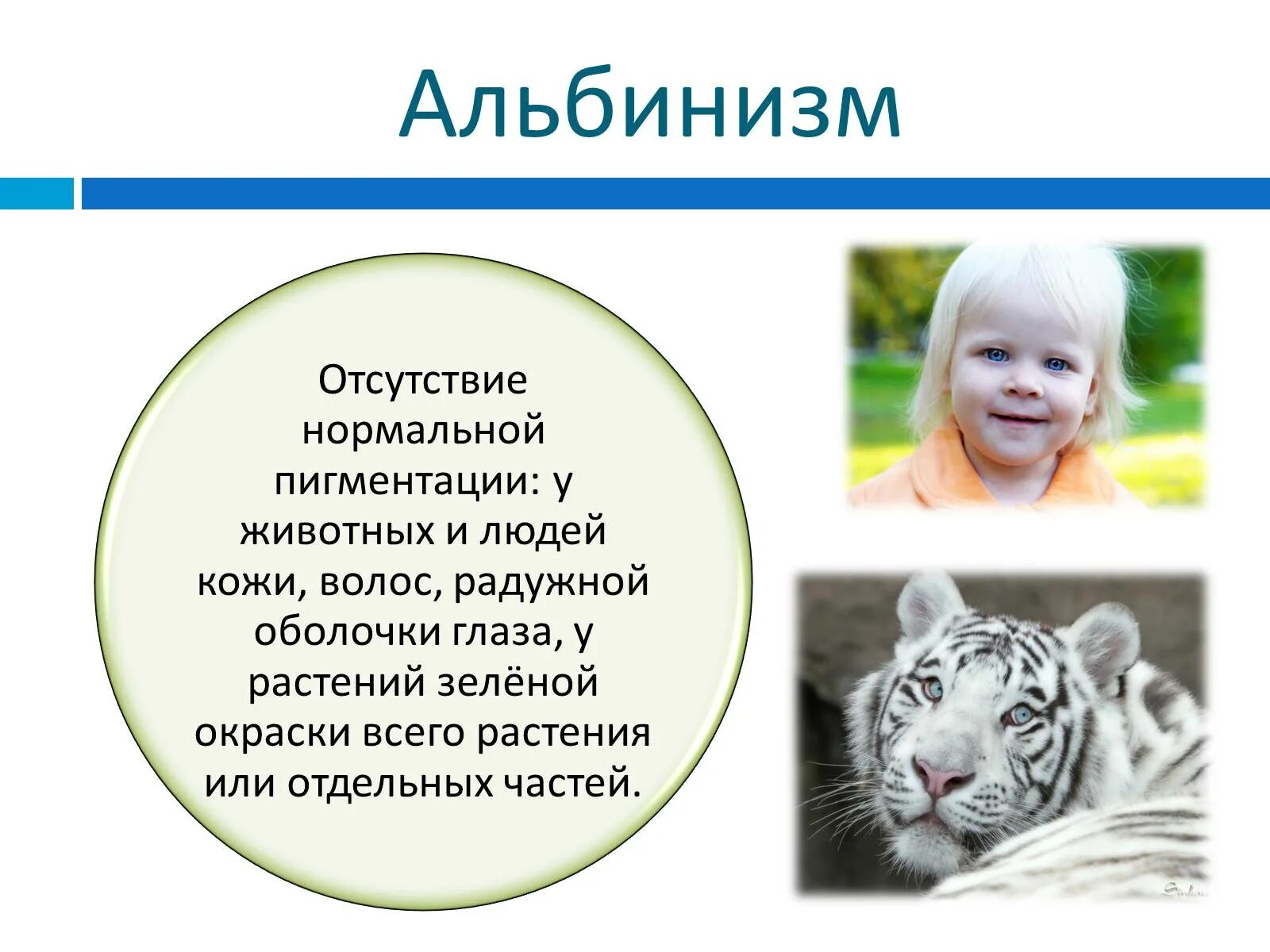 Альбинизм генетика. Альбинизм у животных. признаки альбинизма у животных. альбинизм у животных и растений. альбинизм у человека презентация.