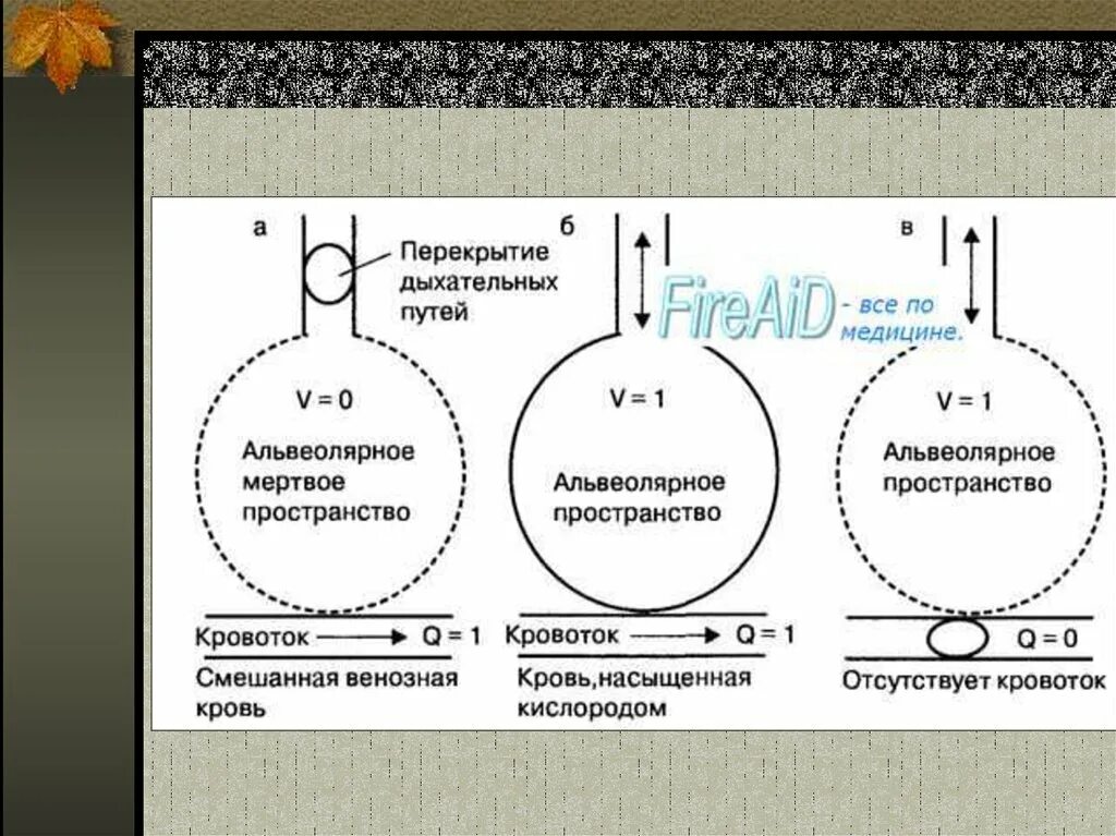 Вентиляционно перфузионное соотношение. Соотношение вентиляции и перфузии в легких. Соотношение между вентиляцией и перфузией легких. Альвеолярное Мертвое пространство. Физиологическое мертвое пространство