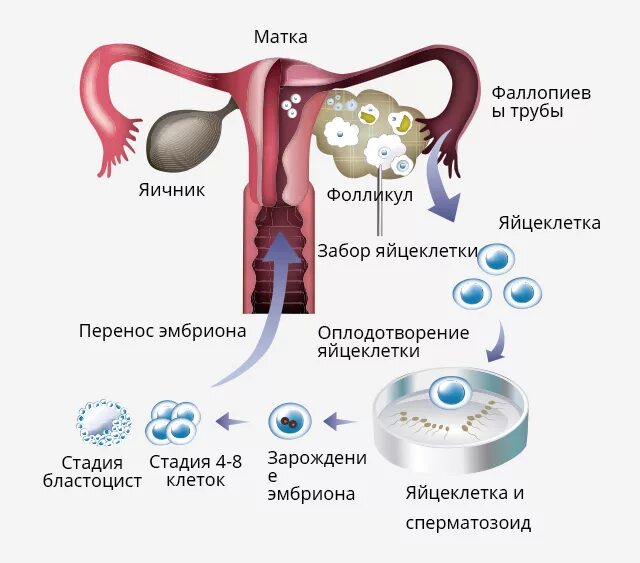 Сколько донорство яйцеклетки. Сколько донорство яйцеклетки