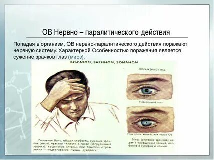 Нервный газ