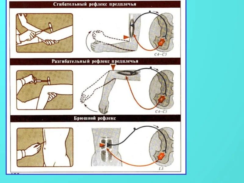 Рефлексы верхних конечностей. Исследование защитных рефлексов. Защитные рефлексы неврология. Защитные спинальные рефлексы. Укоротительный рефлекс.
