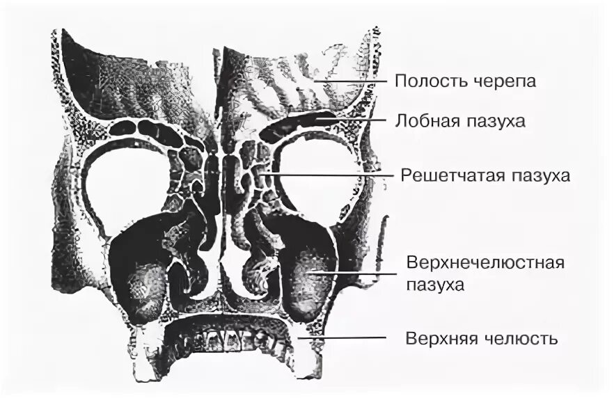 Полости в костях черепа. Лобная пазуха лобной кости. Решетчатая кость лобной пазухи. Анатомия носа и околоносовых пазух на черепе. Кости верхнечелюстной пазухи.