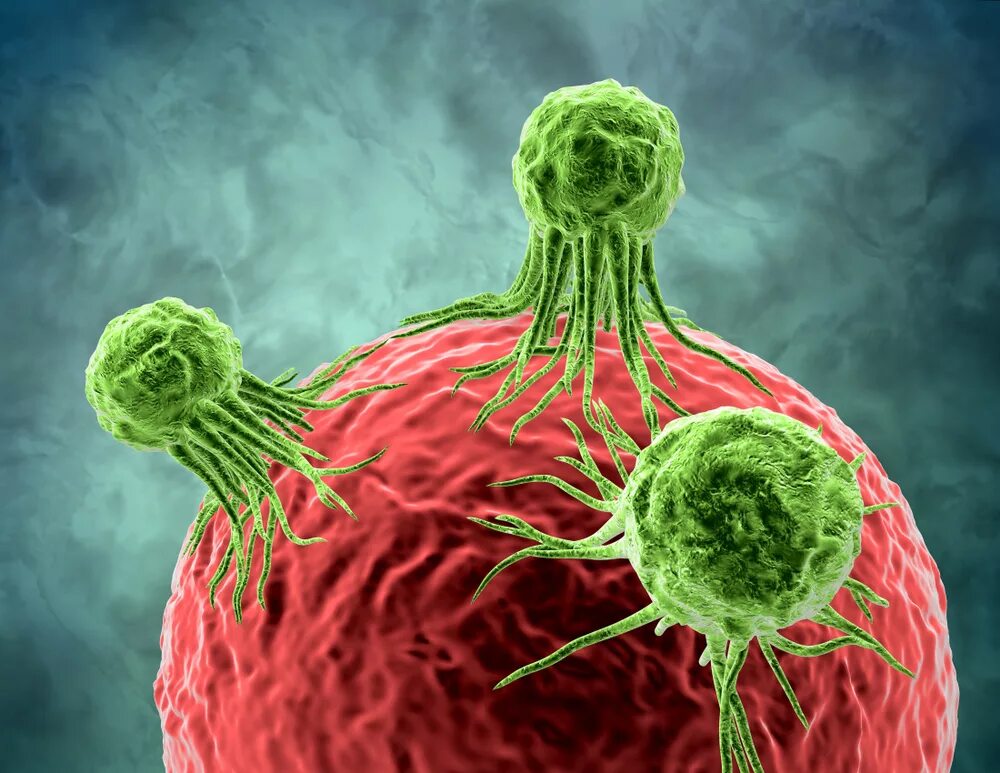 Что такое раковые клетки. Злокачественные клетки. Злокачественные раковые клетки. Клетки злокачественной опухоли. Злокачественные опухолевые клетки.