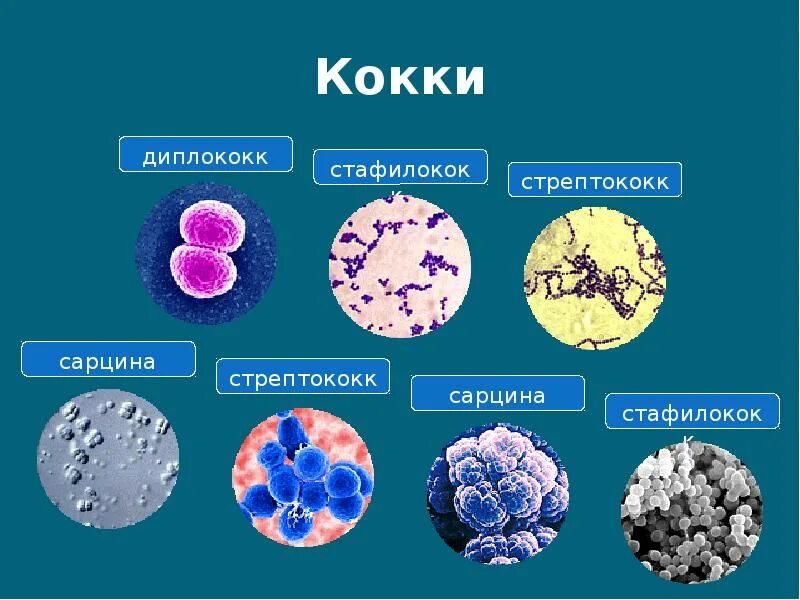 Шаровидные формы бактерий. Кокки значительно. Кокки значительно. Стафилококк ауреус микробиология. Кокки значительно.