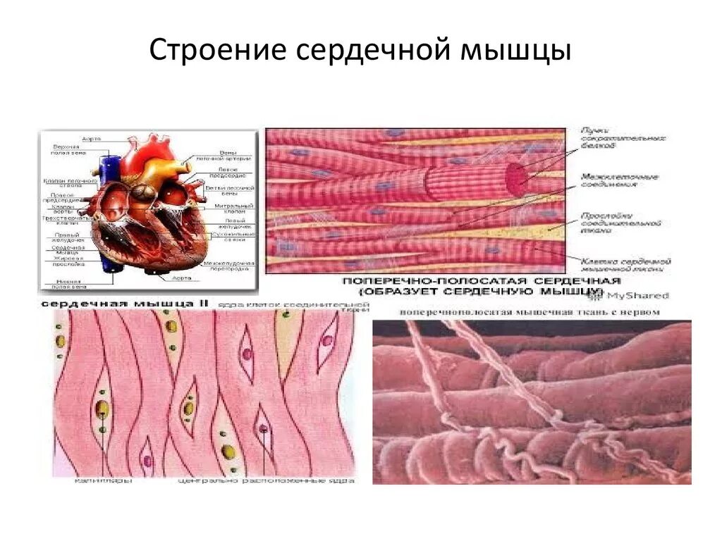 Сердечная мышца представлена тканью. Сердечные мышцы человека строение. Мышечная ткань (миокард) строение. Строение сердечной мышцы ткани. Строение сердечная мышци.