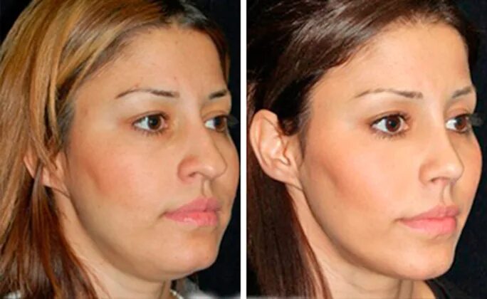 щека поэтому. щека поэтому. щека поэтому. щека поэтому. массажер от брылей на лице.