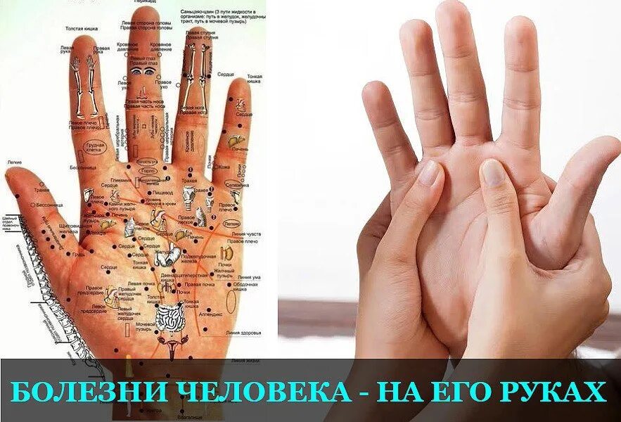 Определить заболевание по рукам. Заболевания по ладони. Болезни по руке человека. Болезни по ладоням рук. Определение болезни по руке человека.