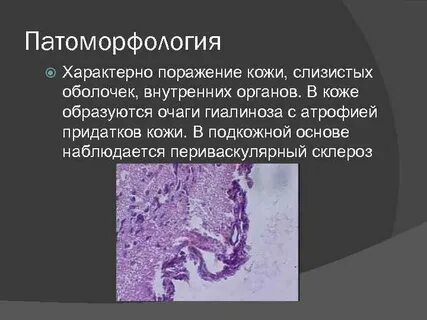 Патоморфология