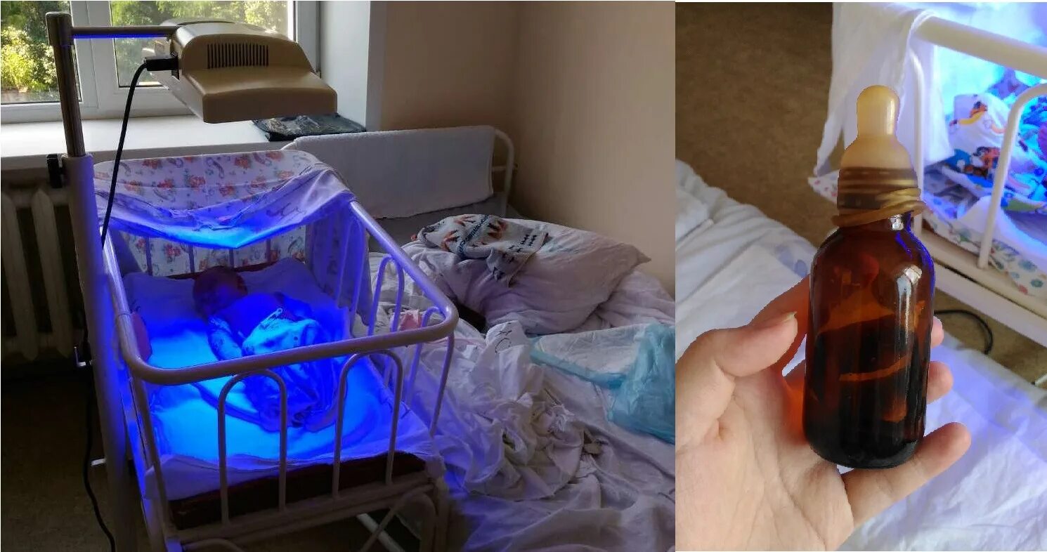 Фототерапия при желтухе. Аппарат для фототерапии новорожденных от желтушки. Фототерапия для новорожденных при желтухе.
