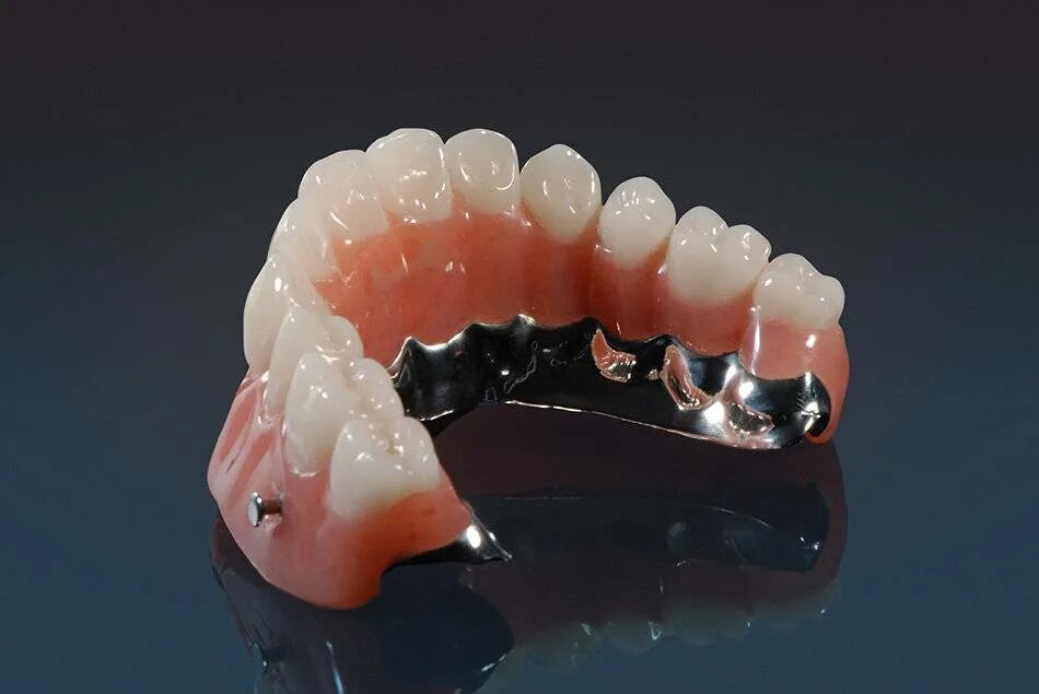 07. зубные протезы съемные. бюгельный квадротти бабочка. полные съемные зубные протезы. акриловые зубные протезы изготовление.