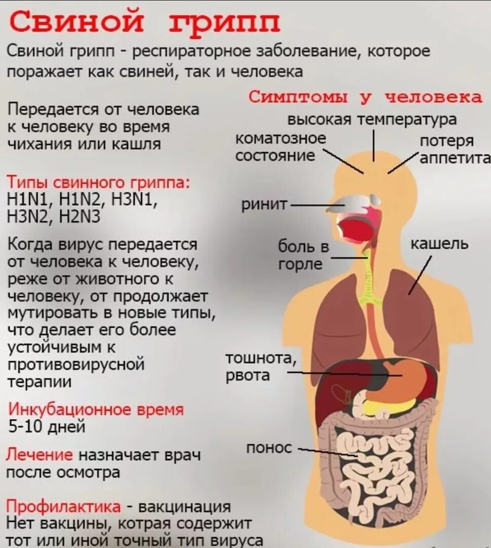 Свиной грипп. Свиной грипп симптомы. Свиной грипп симптомы у людей.