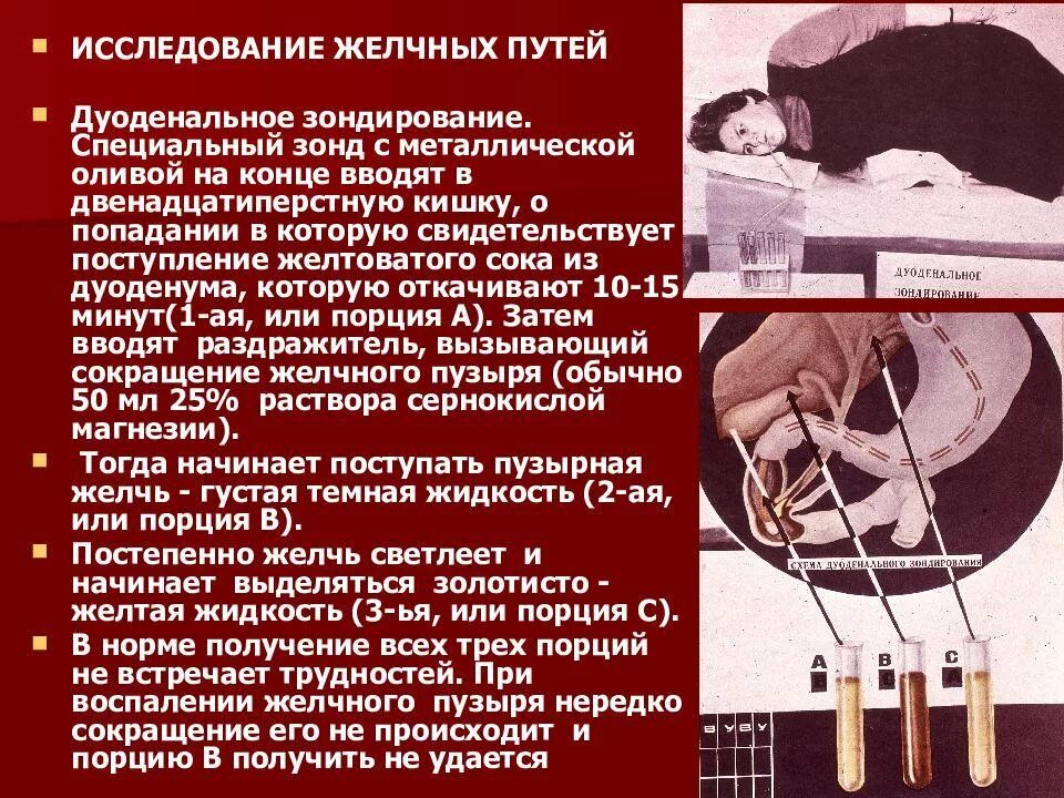 Исследование желчи. Дуоденальное зондирование. Дуоденальное зондирование желчного пузыря. Дуоденальный зонд. Дуоденальное зондирование желчного пузыря зонд.