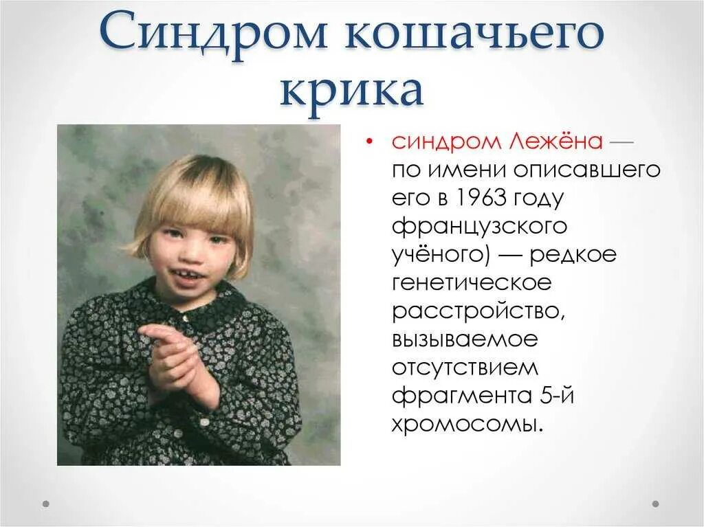 Кошачья болезнь у детей. Клинические симптомы кошачьего крика. тип наследования кошачьего крика. синдром кошачьего крика (моносомия 5р). генетическое заболевание болезнь кошачьего крика.