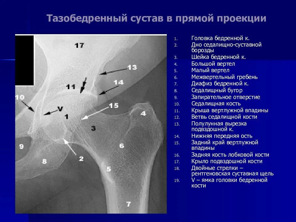Прямая проекция рентгенографии