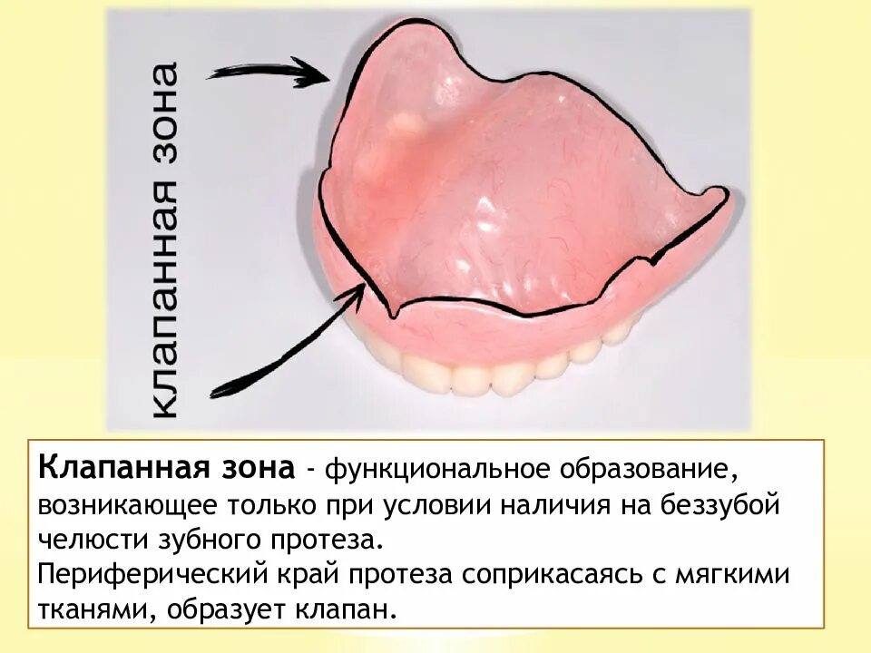 Границы пластиночного протеза. Клапанная зона полного съемного протеза. Клапанная зона в стоматологии. Клапанная зона это понятие. Фиксация протезов на беззубых челюстях.