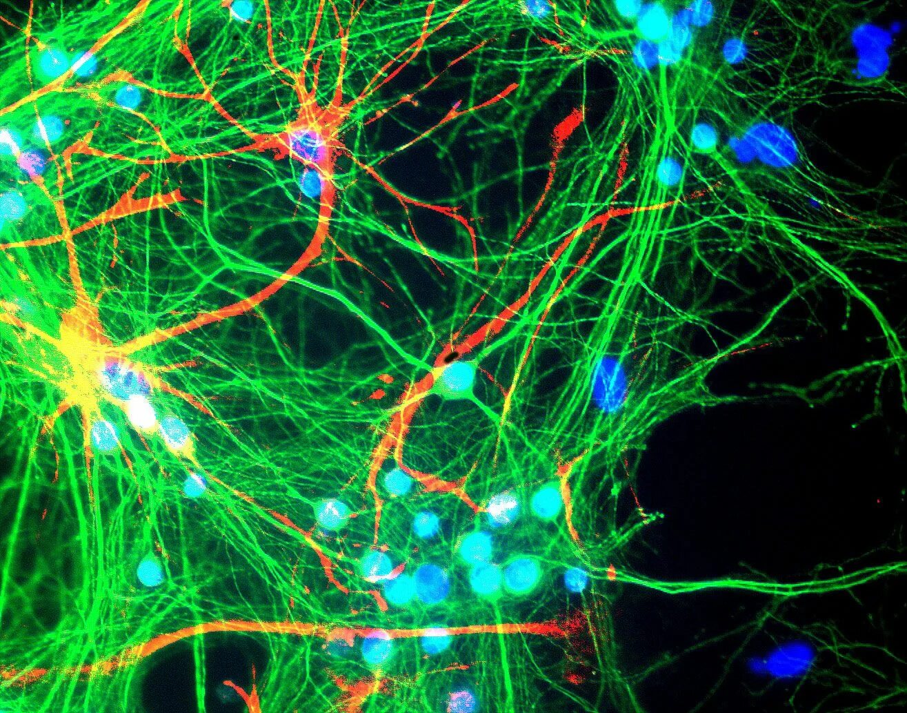 Радиобиология. Нейроны мозга. Веселый Нейрон. Антитела Map-2.