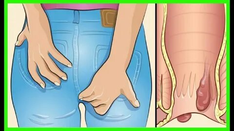 Тәбетті жетілген есектер