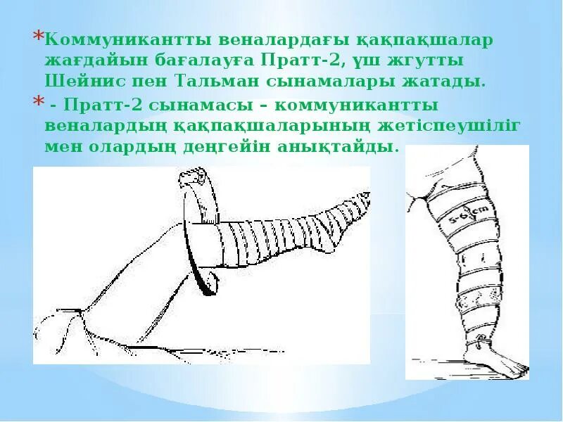 Проба дельбе-пертеса маршевая проба. - маршевая проба дельбе-пертеса проба мейо-пратта. Функциональная проба мейо пратта. Трехжгутовая проба берроу-шейниса. Броди троянова тренделенбурга.