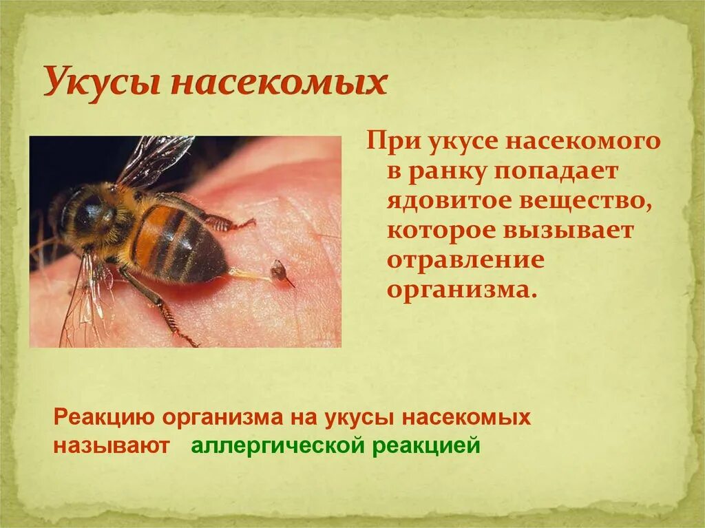 1 помощь при укусе осы. Оказание пмп при укусе насекомых. укусы насекомых первая помощь при укусах.