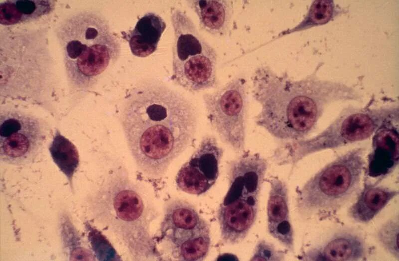 Chlamydia trachomatis. Хламидия трахоматис под микроскопом. Хламидии под микроскопом.