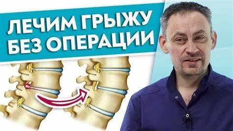 Как убирали грыжу отзывы
