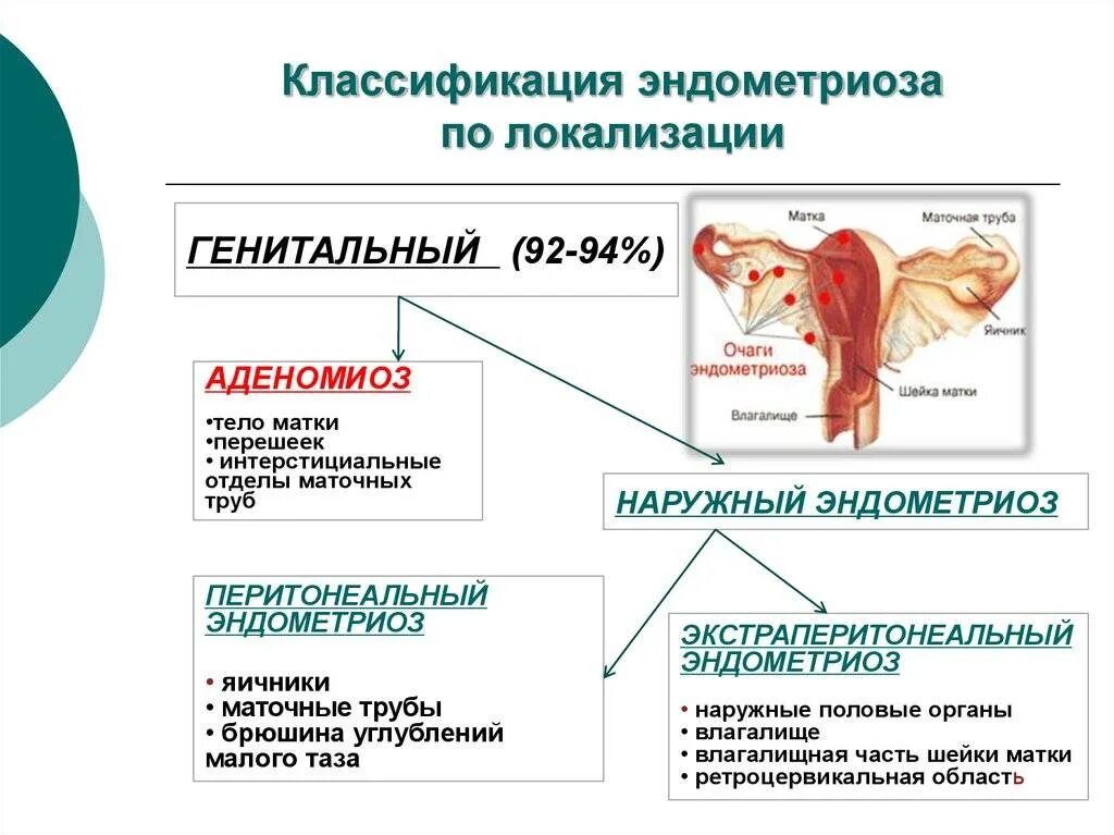 Рак матки психосоматика. Эндометриоз психосоматика. Эндометриоз классификация. Классификация наружного эндометриоза. Классификация эндометриоза по локализации.