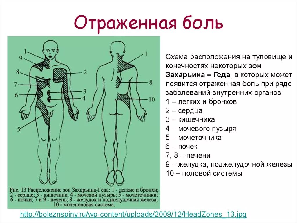 Боле это где. Зоны Захарьина-Геда схема и описание. Отраженная боль в зоне Захарьина-Геда. Дерматомы Захарьина Геда. Феномен Захарьина–Геда.