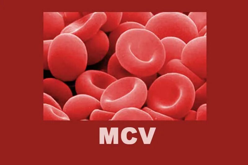E mcv. E mcv