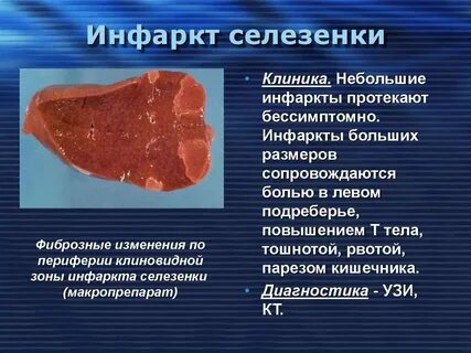 Боль в селезенке после