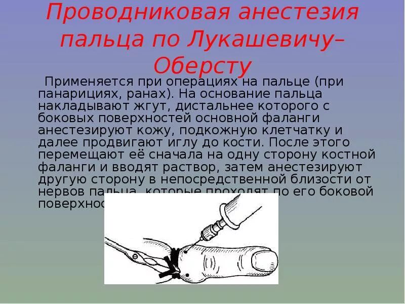 Наркоз применяемый при операциях. Блокада Оберсту Лукашевичу. Проводниковая анестезия по Оберсту-Лукашевичу показания техника. Проводниковая анестезия пальца по Лукашевичу-Оберсту. Проводниковая анестезия Оберст Лукашевич.