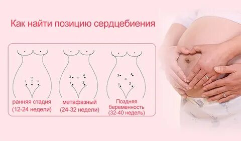 Доплер где слушать
