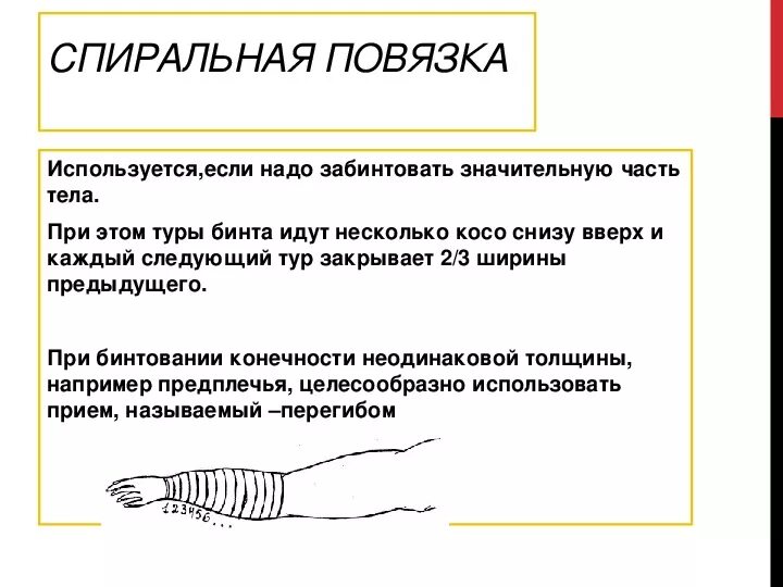 Спиральная повязка техника наложения