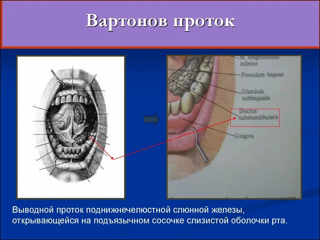 Общий выводной проток подчелюстной железы. Поднижнечелюстная слюнная железа выводной проток. Выводной проток слюнной железы. Вартонов проток. Выводной проток подчелюстной слюнной железы анатомия.