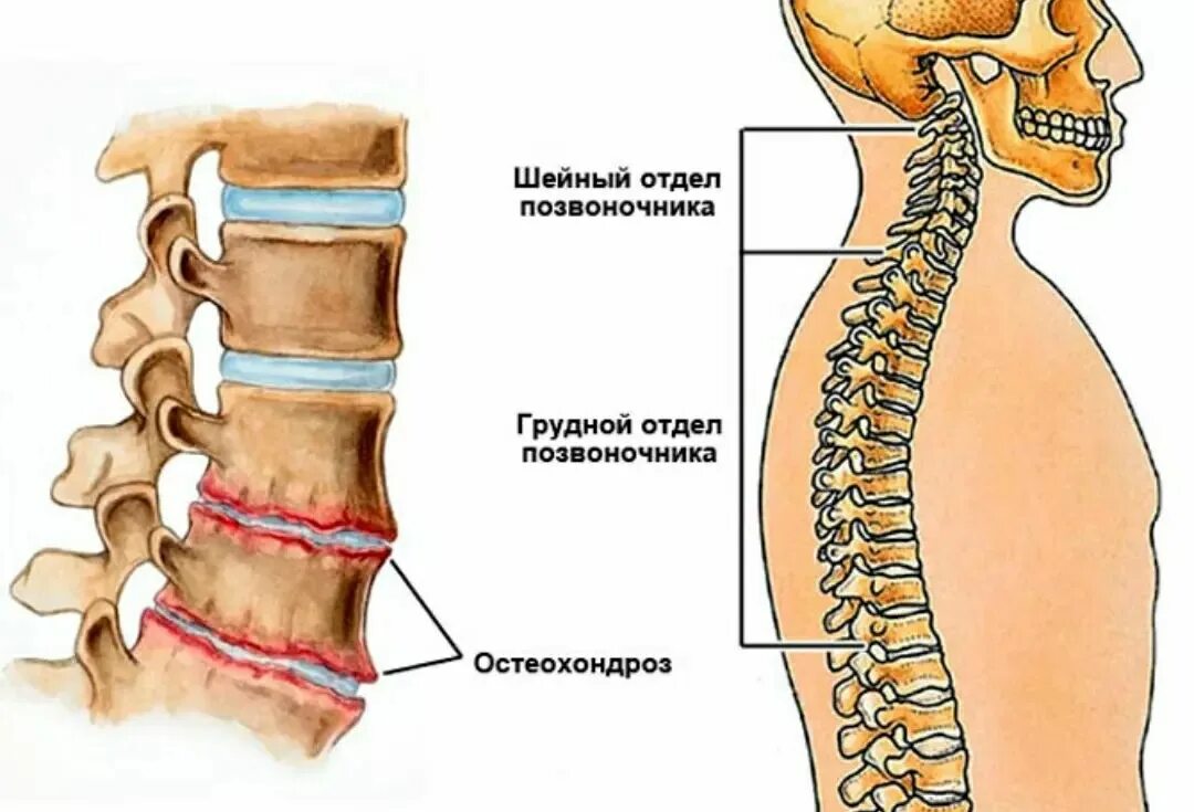шейный отдел позвоночника состоит из 7 позвонков грудной из. механизм развития остеохондроза позвоночника. позвоночник шейного отдела и спинного. болит шейный отдел позвоночника. позвоночник шейного отдела и спинного.