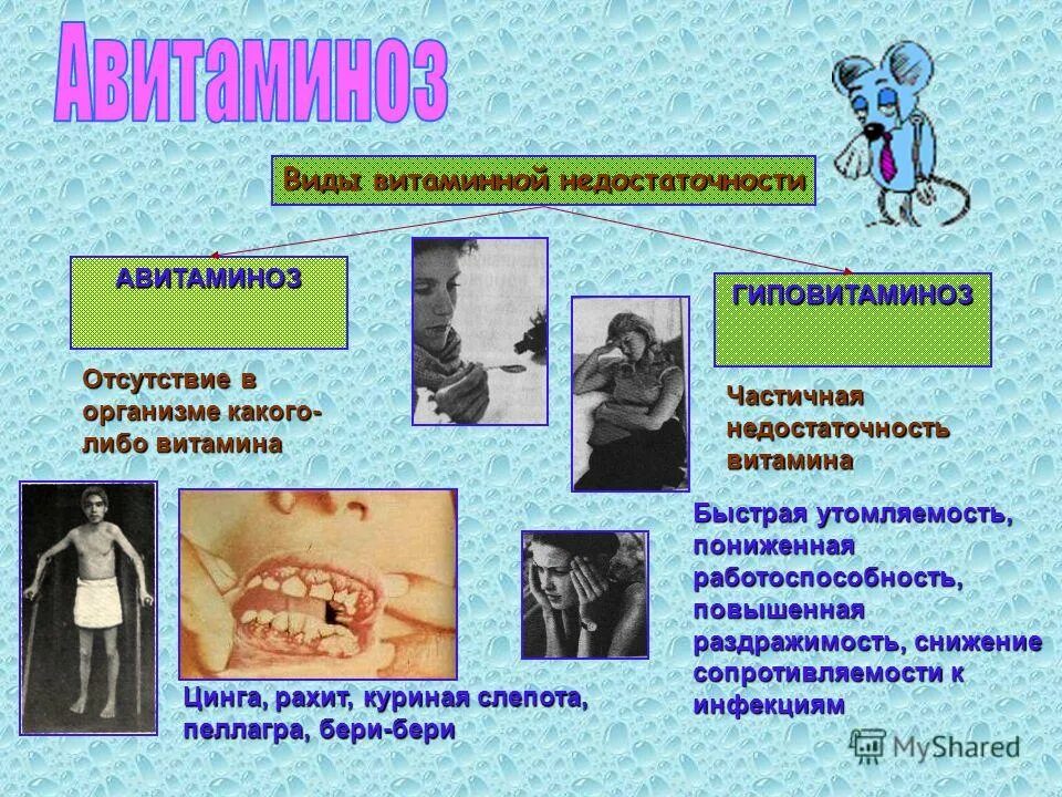 признаки дефицита витамина в2. признаки авитаминоза витамина в2. авитаминоз б. авита миноз и гиперавитпаминоз. авитаминоз витамина в3 симптомы.