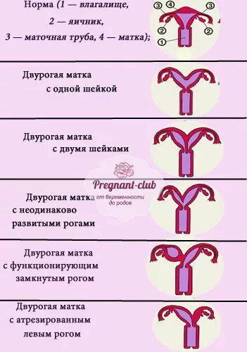 Какого размера матка у женщины в обычном. Двурога матки и бкременность. матка неправильной формы. двурогая матка и беременность.
