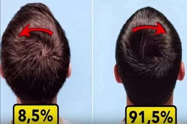 Направление роста волос. Рост волос на голове. Рост волос на затылке схема. Рост волос на макушке у мужчин.