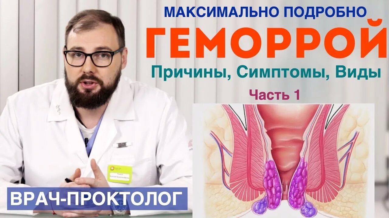 Врач при геморрое у мужчин