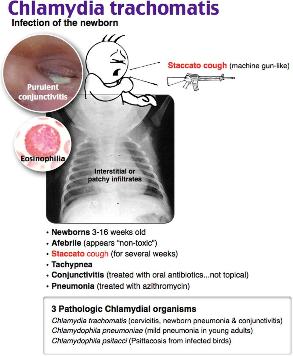 Кашель хламидии. Хламидия трахоматис у мужчин. Хламидия трахоматис фото.