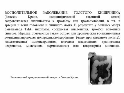 Заболевание толстой кишки симптомы
