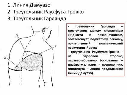 Звуки грудной клетки