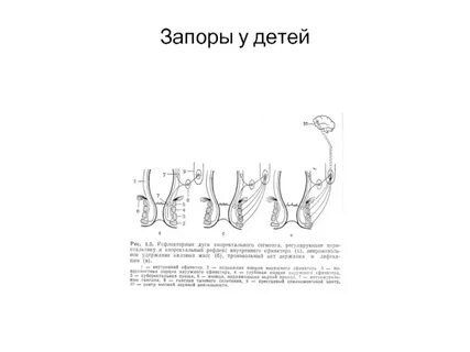 Долихосигма кишечника лечение у взрослых с запорами