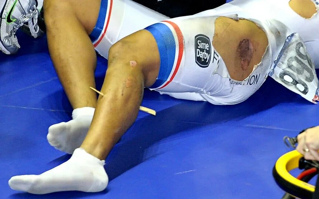 Травмы спортсменов. Жесткие спортивные травмы.