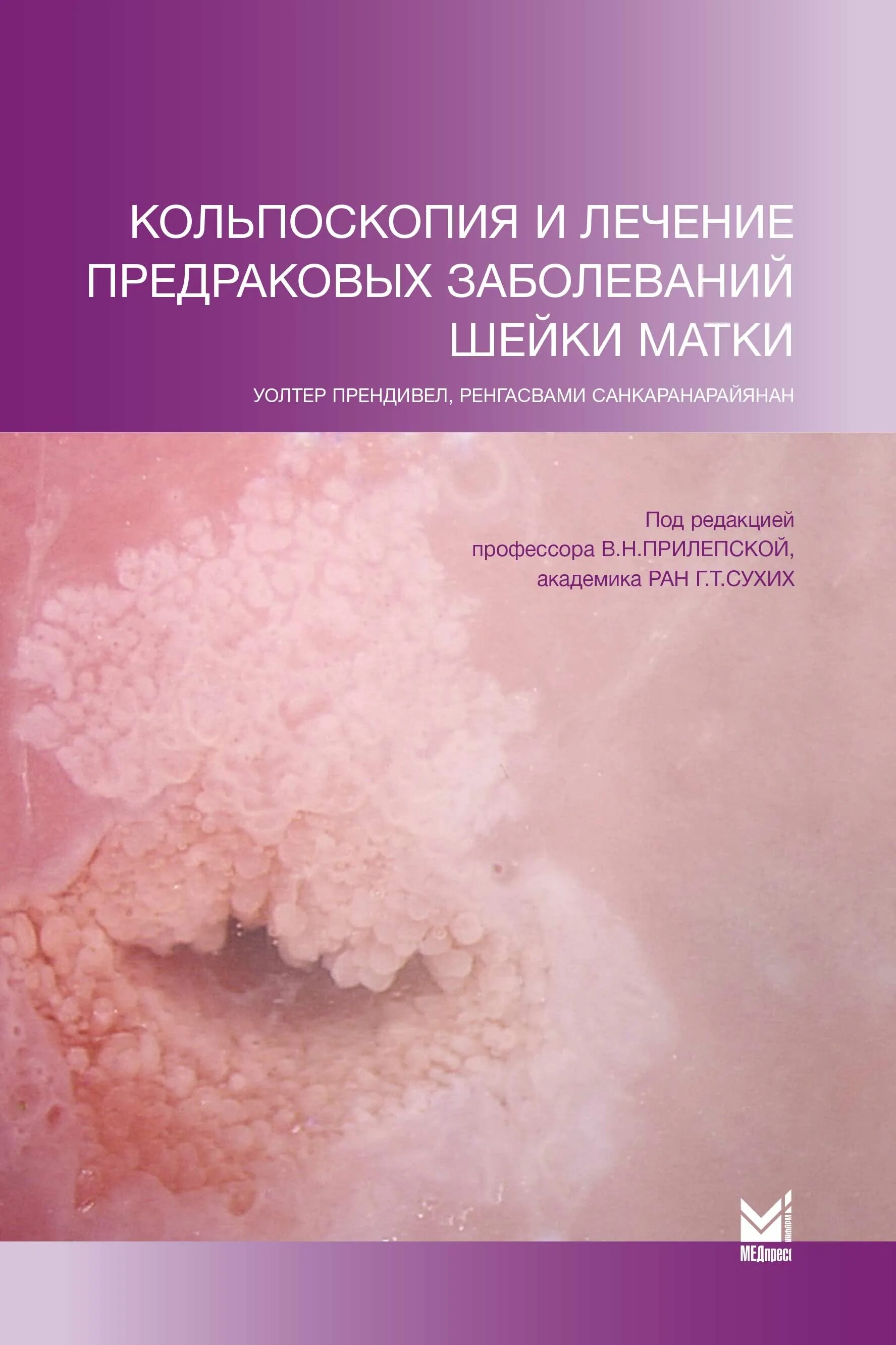 Лечение предраковых заболеваний. Предраковые заболевания шейки матки лечение. Патологии шейки матки кольпоскопия. Кольпоскопия патология шейки.