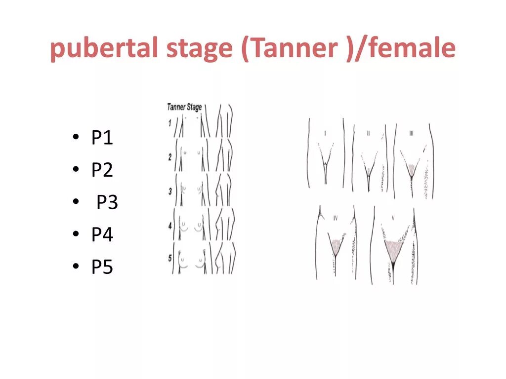 Женские малые половые губы. Оволосение по Таннеру. Стадии полового развития у девочек по Таннеру. Оценка полового развития по Таннеру у девочек. Степень развития по Таннеру.