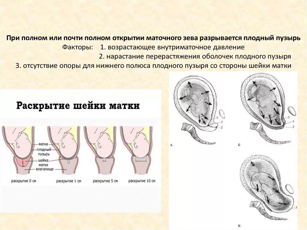 Выходит матка после родов. Клинические признаки открытия маточного зева. Раскрытие маточного зева 3 см. Полное раскрытие маточного зева. Раскрытие шейки.