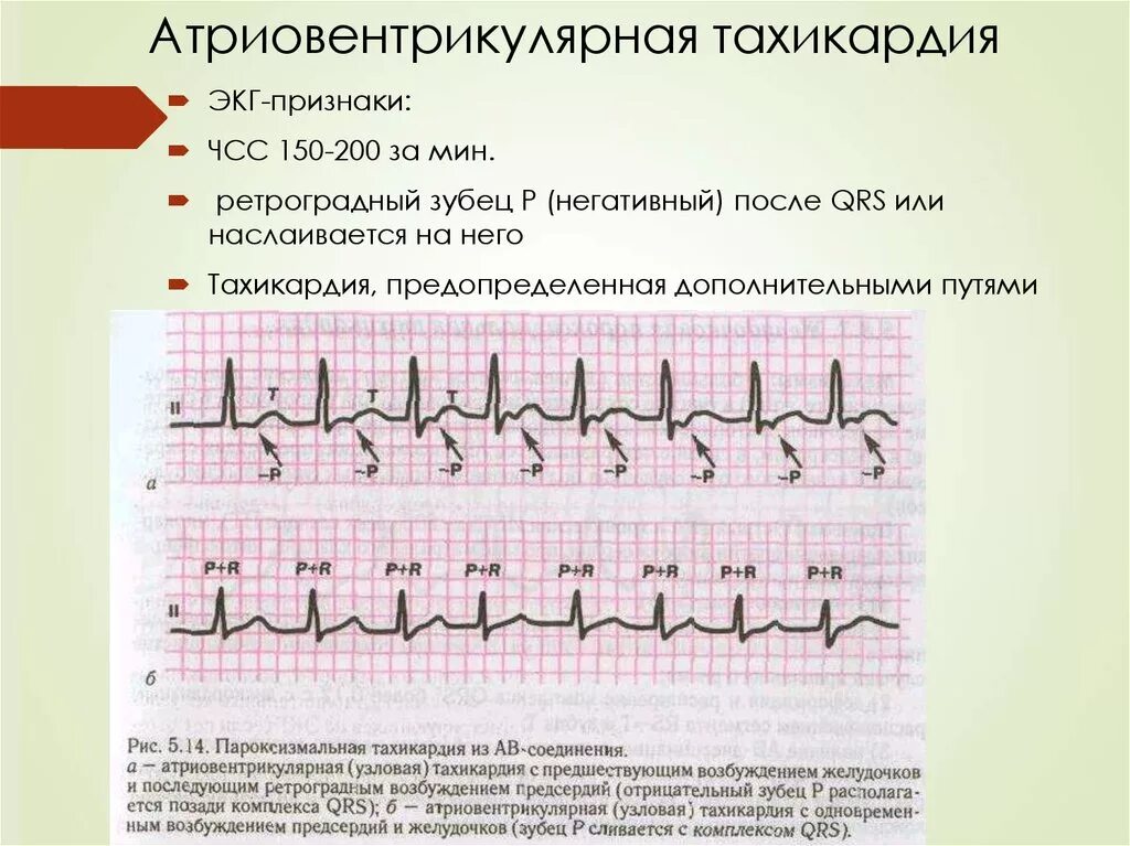 Калий чсс